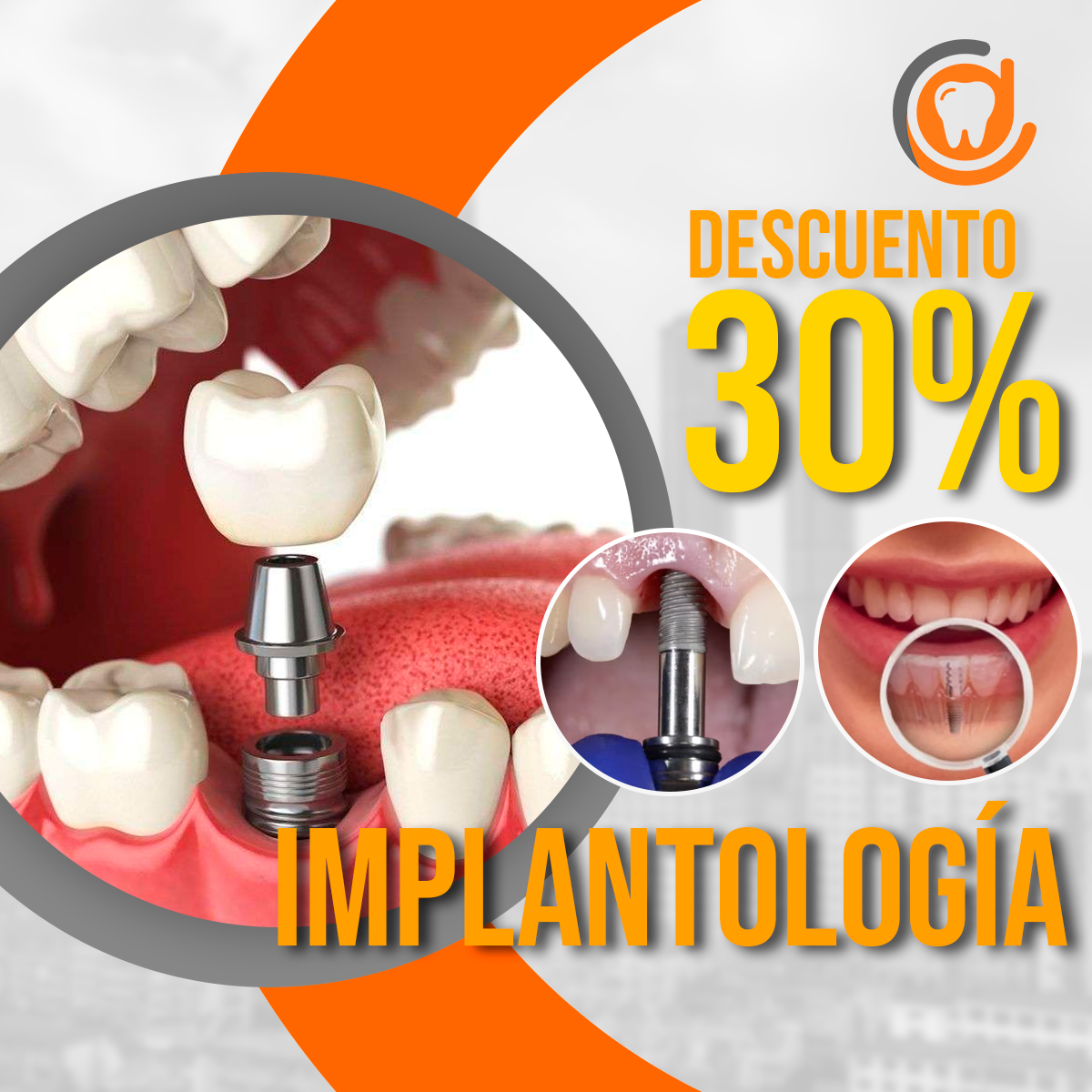 Implantologia thumbnail