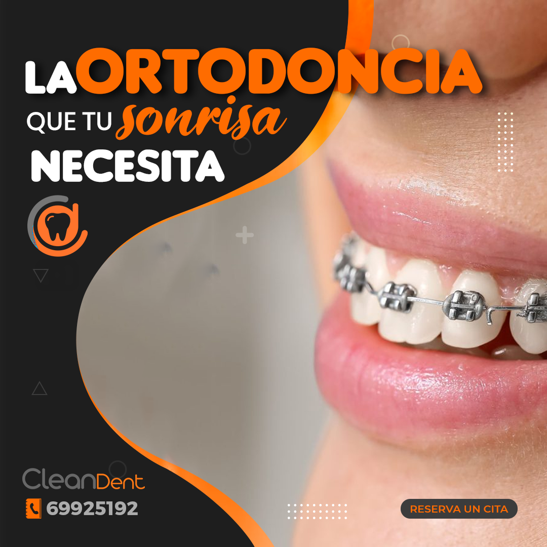 Ortodoncia thumbnail