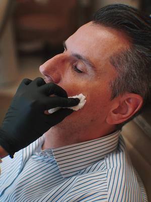 Vem conferir esse video de procedimento realizado num consultorio dermatologico #video #estetica #fyp 