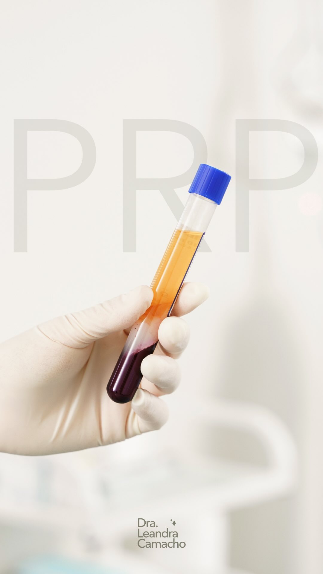 ✨Te mostramos una sesión de PRP junto a @laboratoriodam , como siempre 👏🏻

💉 Extracción sanguínea del paciente

👨‍🔬 Cent