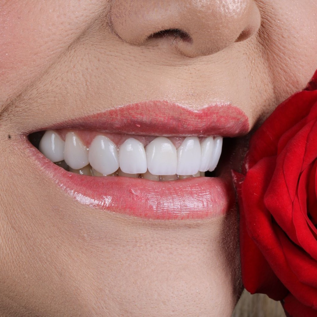 A Clínica dos sorrisos Perfeitos thumbnail