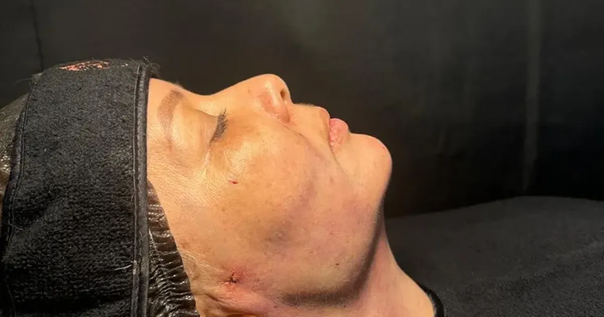 Harmonização Estratégica com Foco em Contorno thumbnail