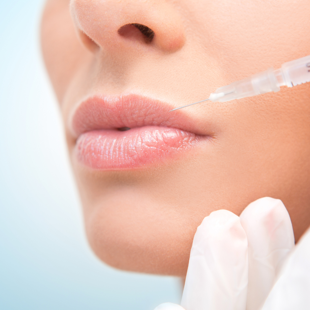 Preenchimento labial  thumbnail