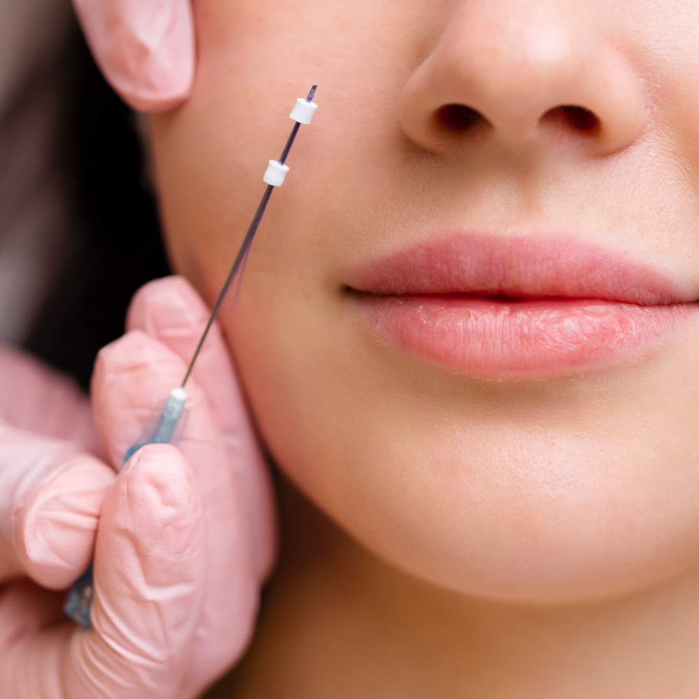 Fios de PDO thumbnail