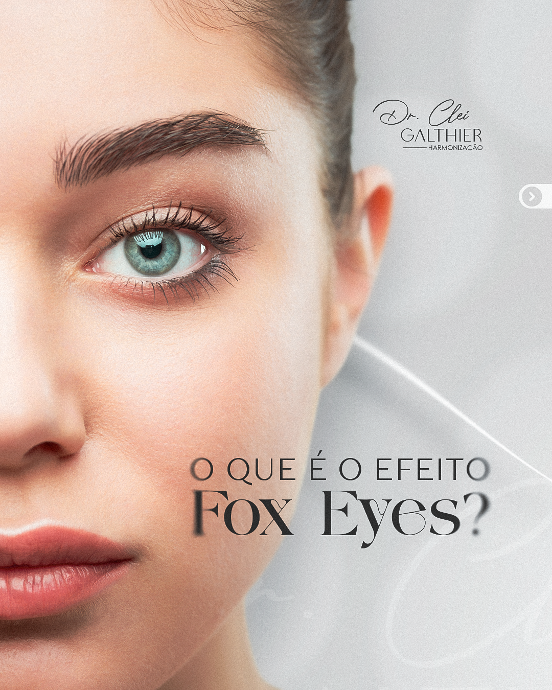 Fox Eyes I Dr. Clei Galthier®️ thumbnail