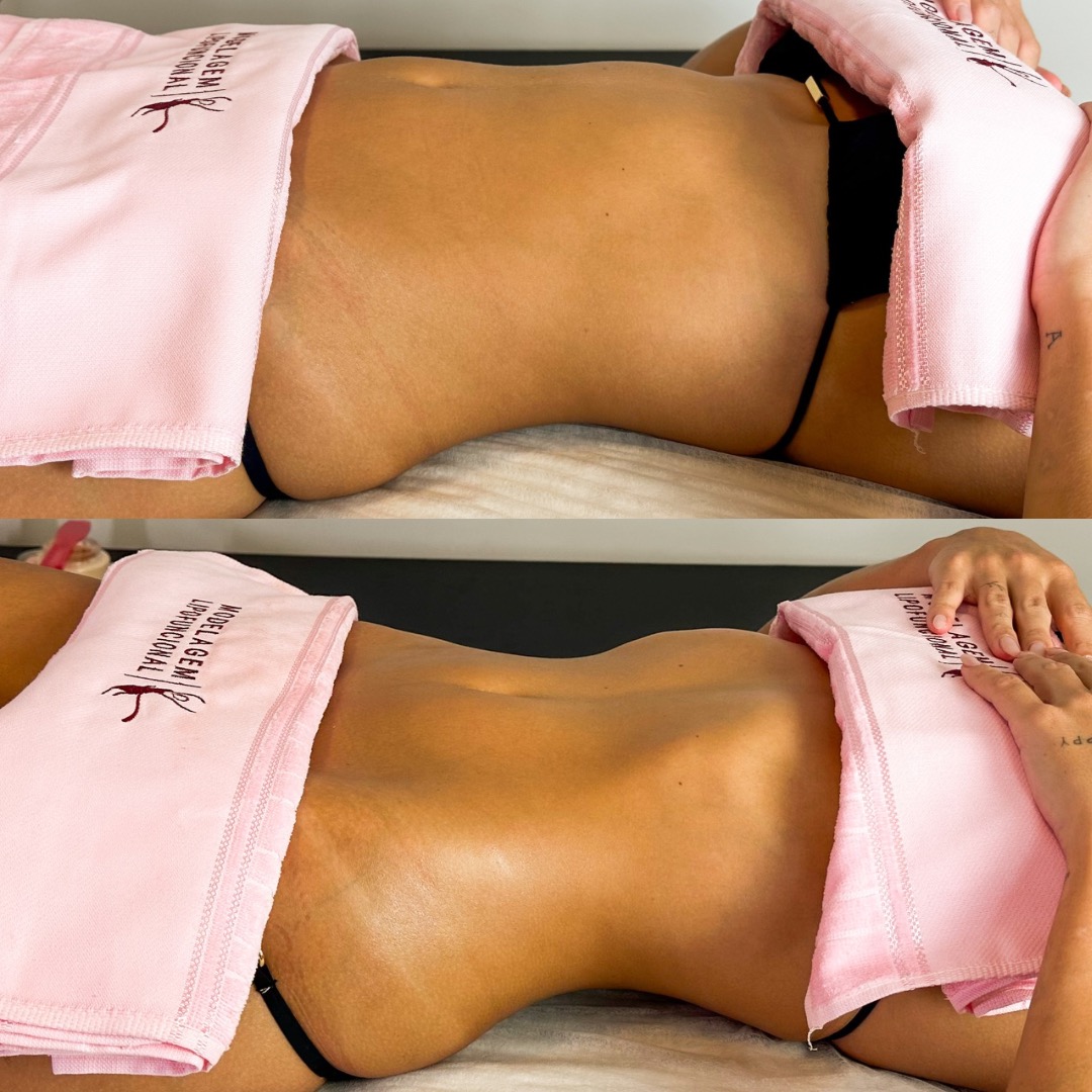 CURSO FORMAÇÃO MODELAGEM LIPOFUNCIONAL thumbnail