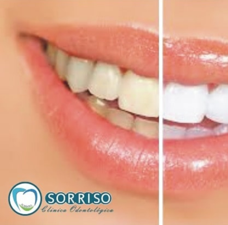 Clínica Sorriso• Odontologia  thumbnail