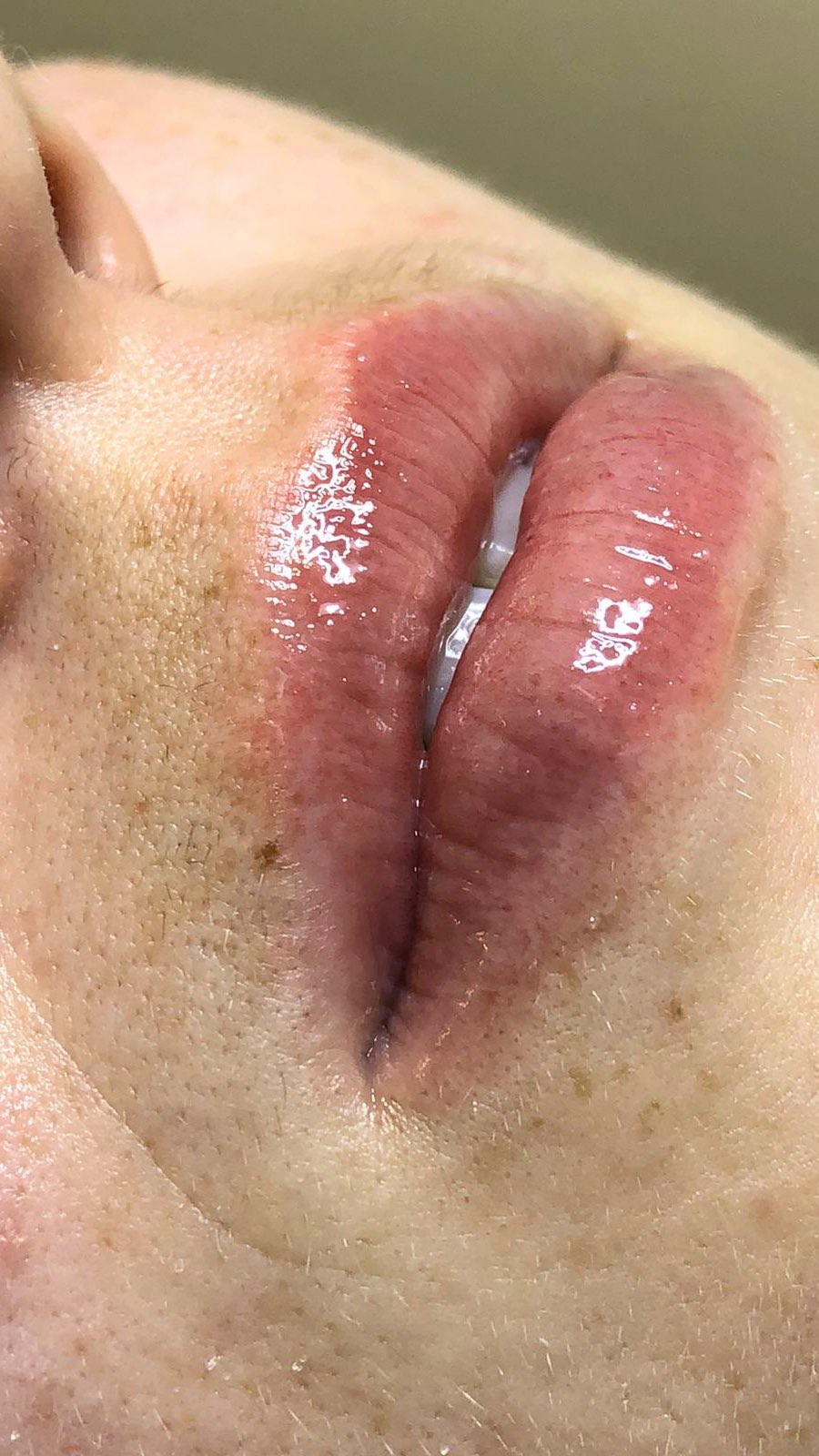 O spa dos lábios, é um queridinho por mim e por quem experimenta também, esfoliação labial faz a remoção de todas célula