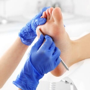 Plástica dos pés  thumbnail