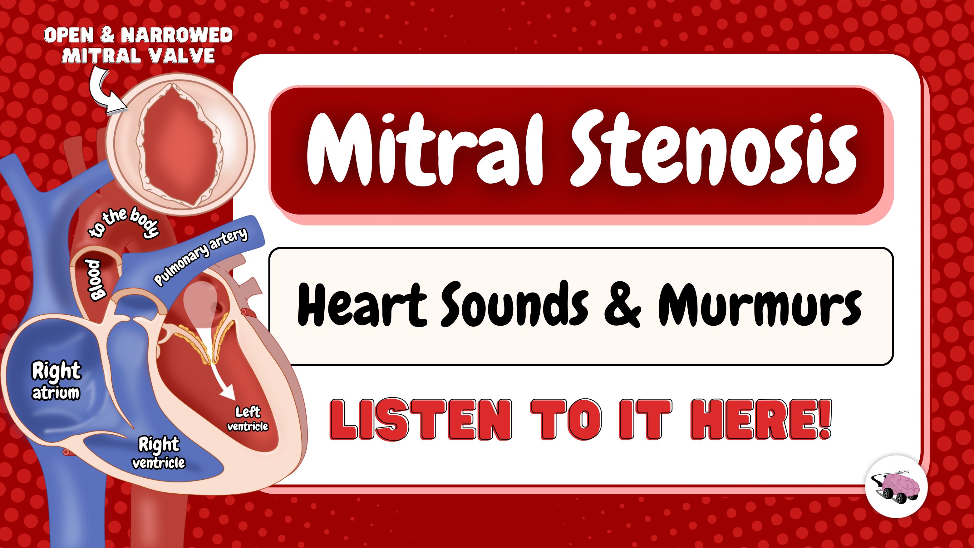 MS thumbnail