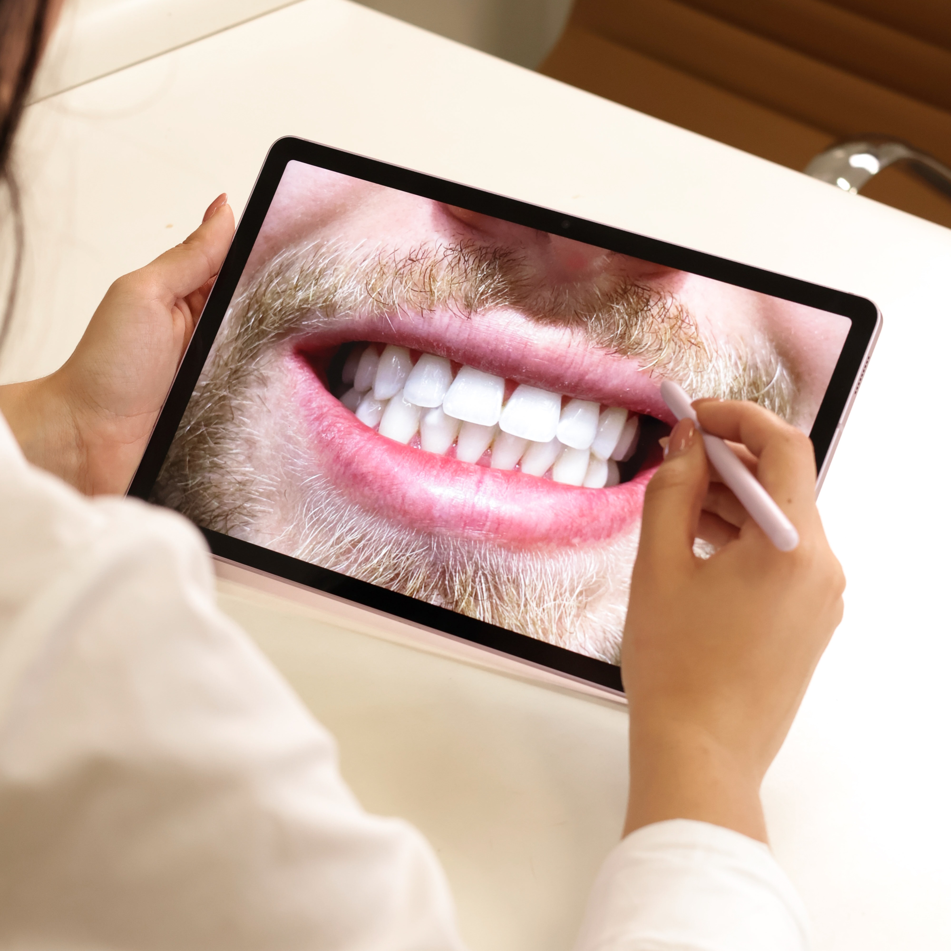 Clique para agendar clareamento dental. thumbnail