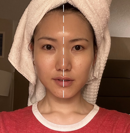 🇰🇷 펩타놀 바로주문링크 thumbnail