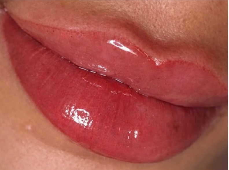 Agendamento para Micropigmentação Labial (Lip Micropigmentation) thumbnail