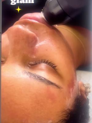 🫧The Glo2Facial by Geneo is the perfect facial to get any time of year! 🫧. Our custom Glo2Facial OxyPods react with a pr