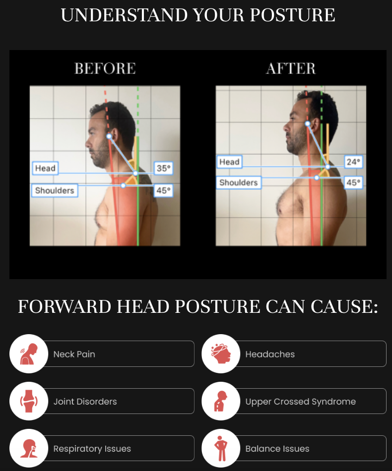 Your Free Posture Assessment  thumbnail