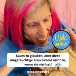 Magersüchtige wog zeitweise unter 20kg! thumbnail