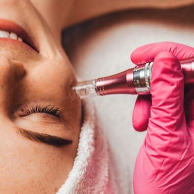 Microagulhamento  thumbnail