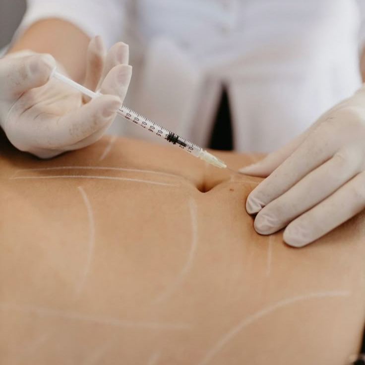 Hidrolipoclasia  thumbnail