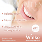 Prótesis sobre Implantes  thumbnail
