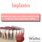 Implantología thumbnail