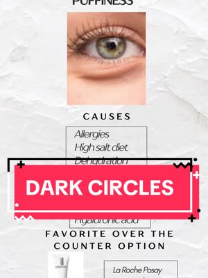 How to help with the appearance of dark circles/ under eye circles - causes and my favorite over the counter options- no