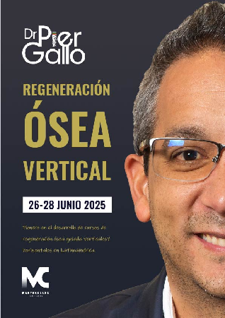Curso Regeneración ósea vertical con Pier Gallo - Masterclass Dentistry thumbnail
