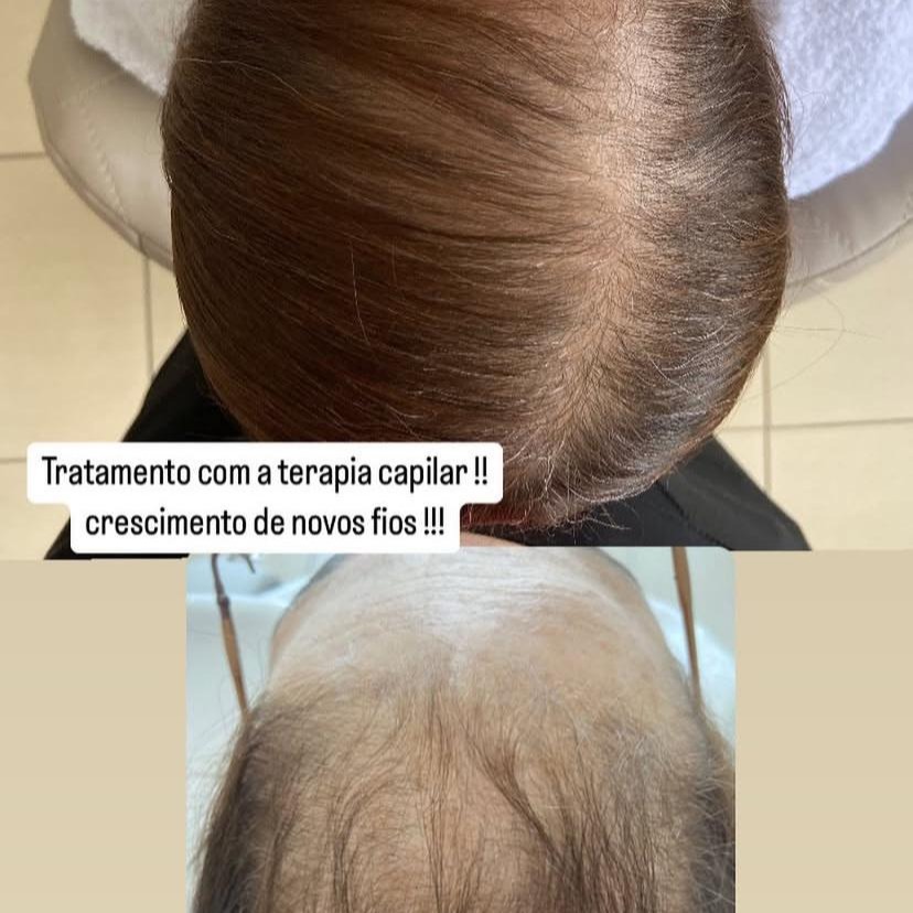 ANTES E DEPOIS thumbnail