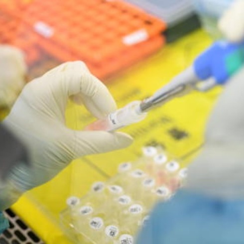 Covid, la nuova variante Cicada esplode. Sfugge alle difese immunitarie per le sue numerose mutazioni thumbnail