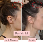 RINGANA - NEIN zu Haarausfall und brüchigen Nägeln thumbnail