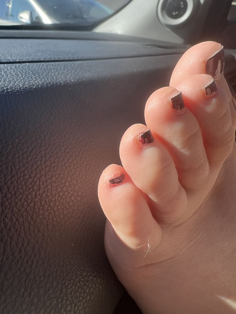 Yelp thumbnail