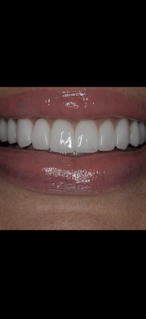 FREE Cosmetic Smile Evaluation Quiz thumbnail