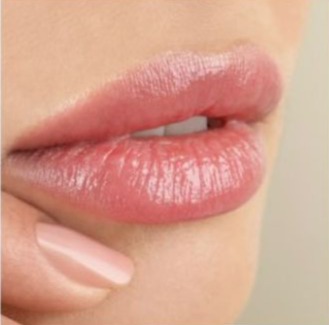 Revita Lips  thumbnail