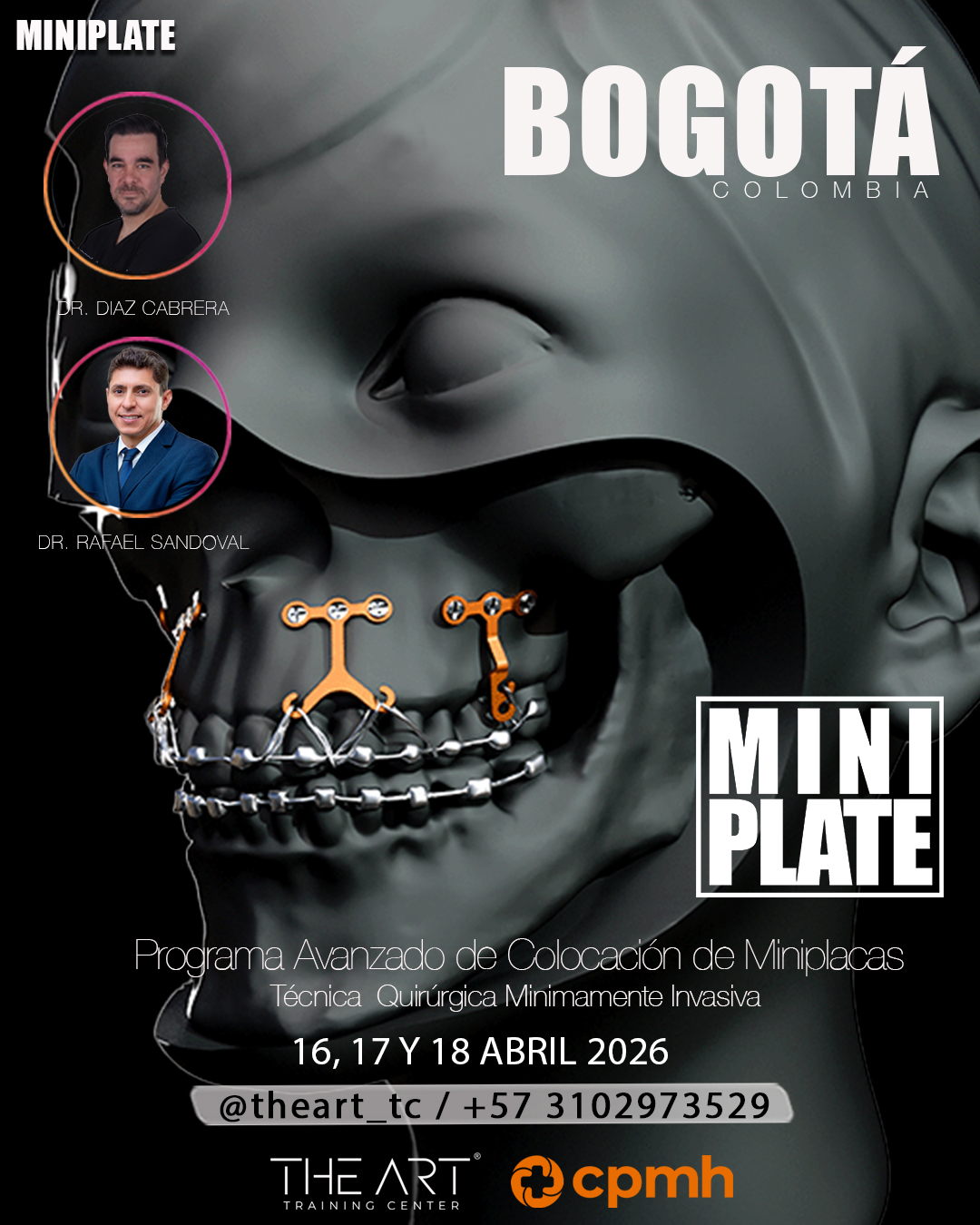   Programa Avanzado de Colocación de Miniplacas thumbnail