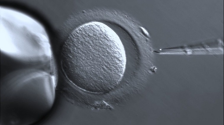 Learn acupuncture to support IVF and FET thumbnail