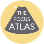 The POCUS Atlas thumbnail