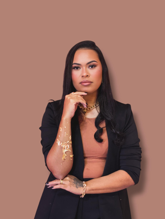 REDE SOCIAL  thumbnail