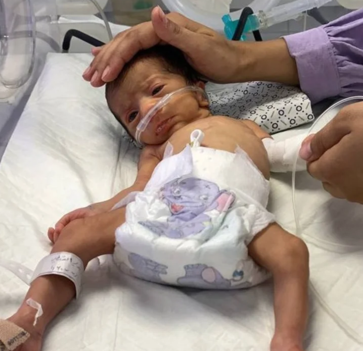  'Catastrophic': Infants in Gaza battle to stay alive amid formula shortage thumbnail
