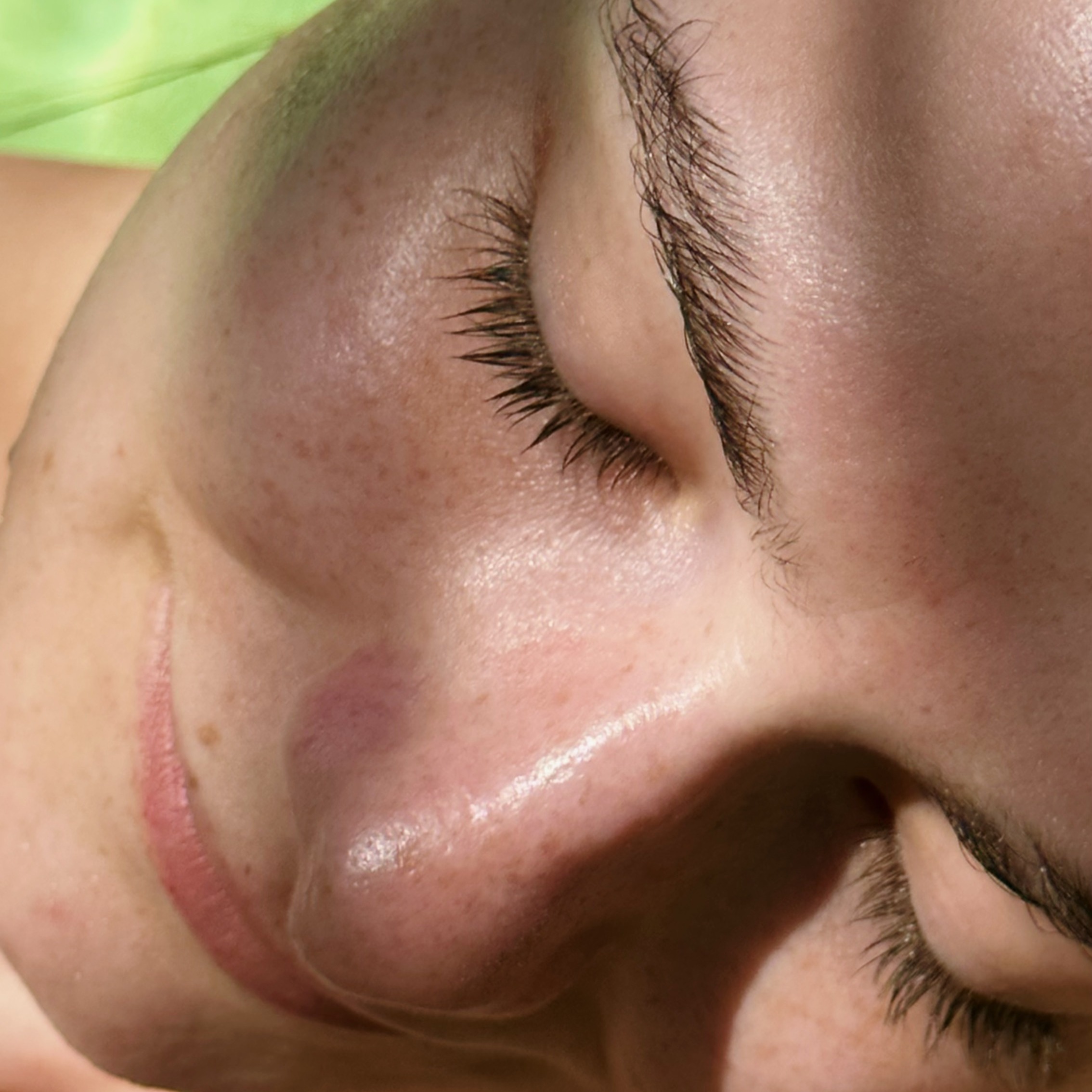 How to FINALLY get Clear Skin thumbnail