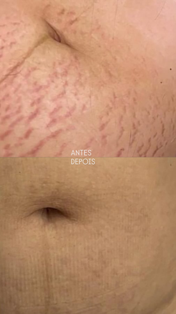 Curso online  thumbnail