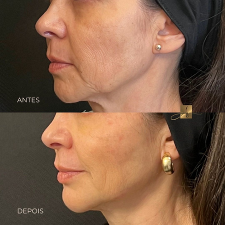 Formação Fácil  thumbnail