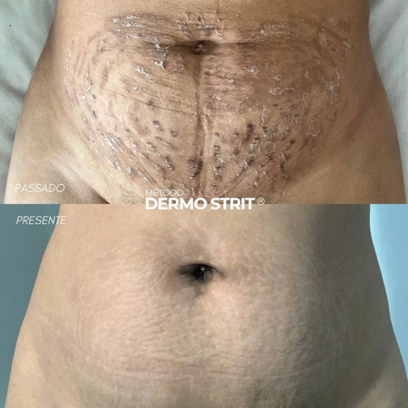 Lista de espera - Formação presencial  thumbnail