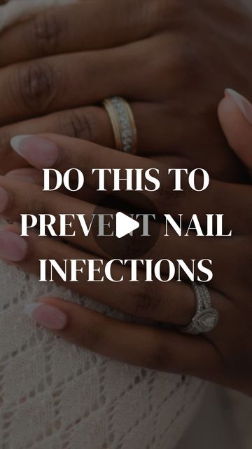 HOW TO PREVENT NAIL INFECTIONS thumbnail