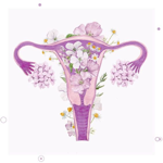 ENDOMETRIOSE  thumbnail