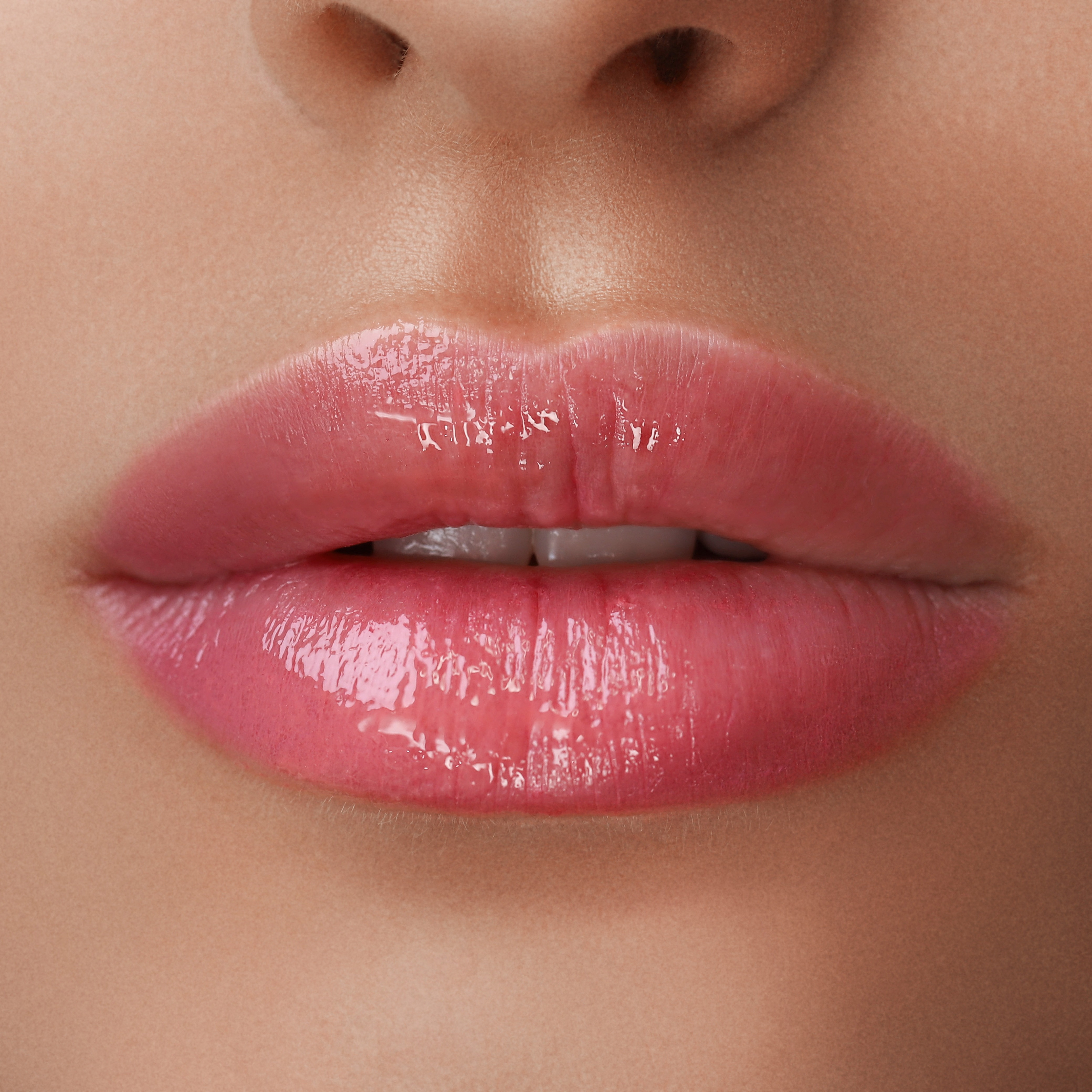 Preenchimento Labial thumbnail
