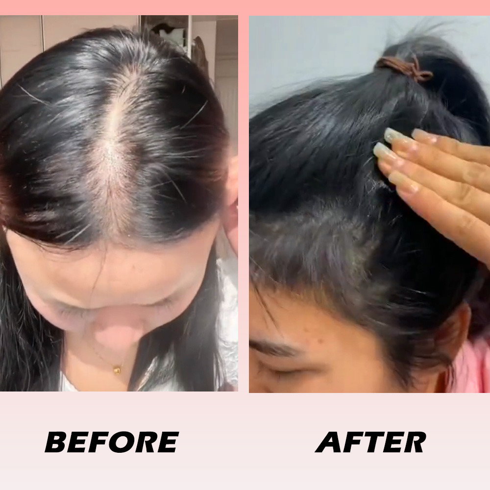 Stimulates hair follicles for real results. thumbnail