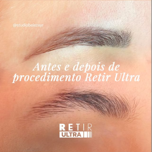 Retir Ultra thumbnail