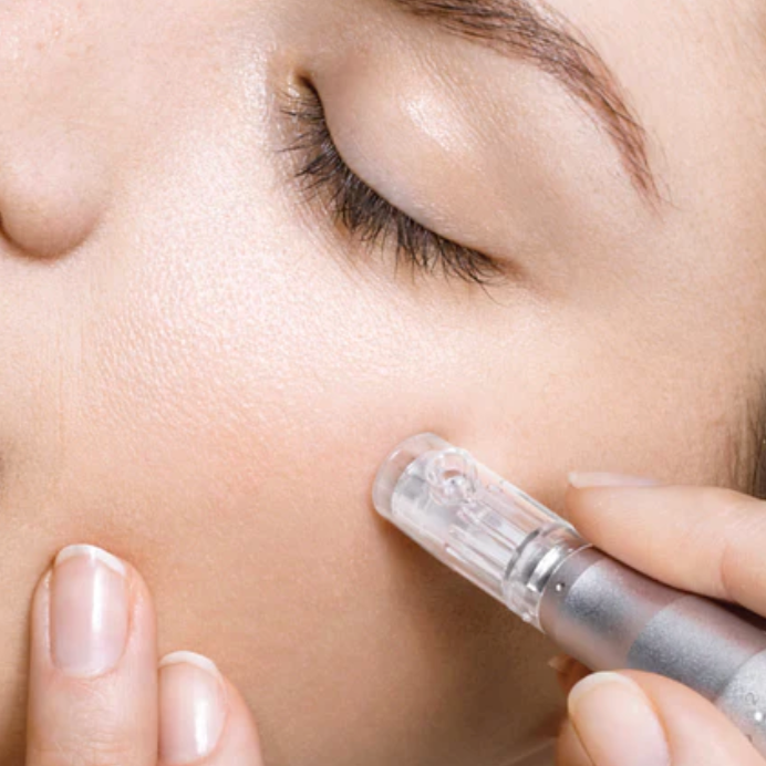 Microneedling thumbnail