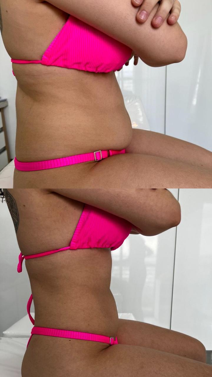 Entenda o procedimento thumbnail