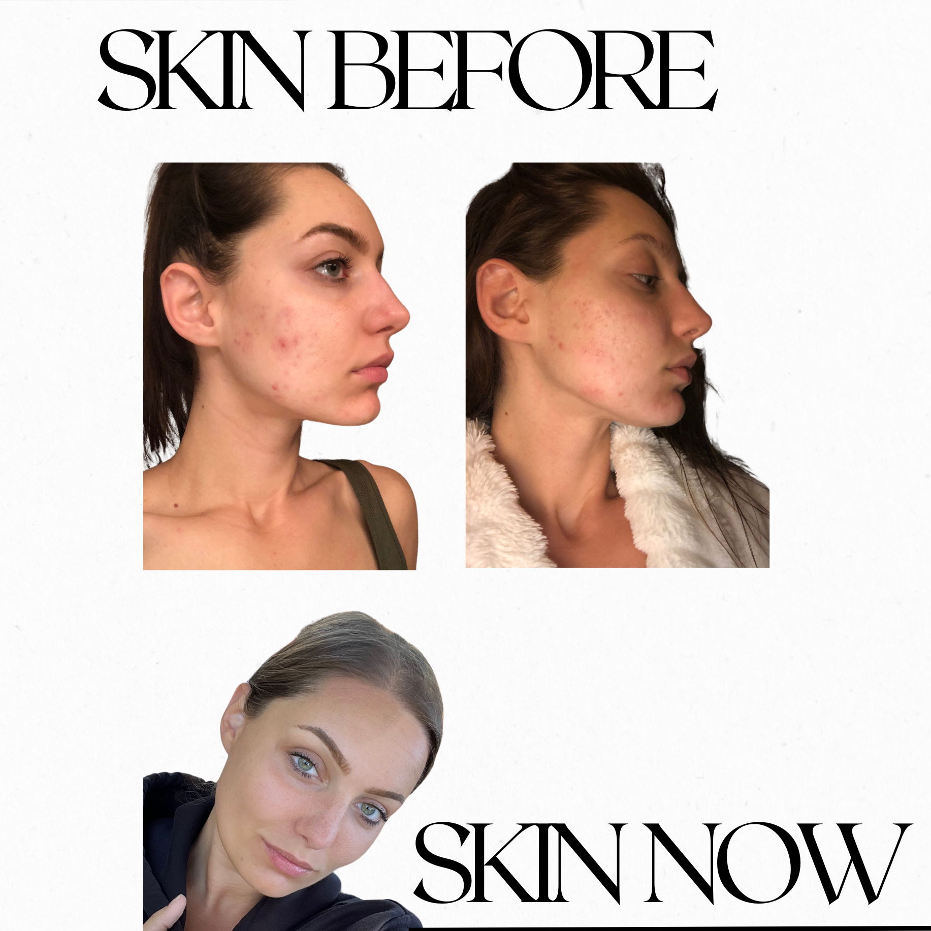 Skin Transformation  thumbnail
