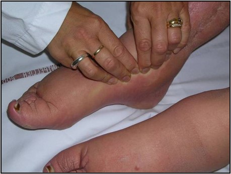 LINFOLOGIA & ANGIOLOGIA thumbnail